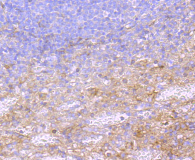 Anti-Alpha-2-macroglobulin Antibody (9L785)