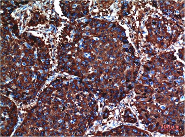 Anti-AKT1 Antibody (9U632)