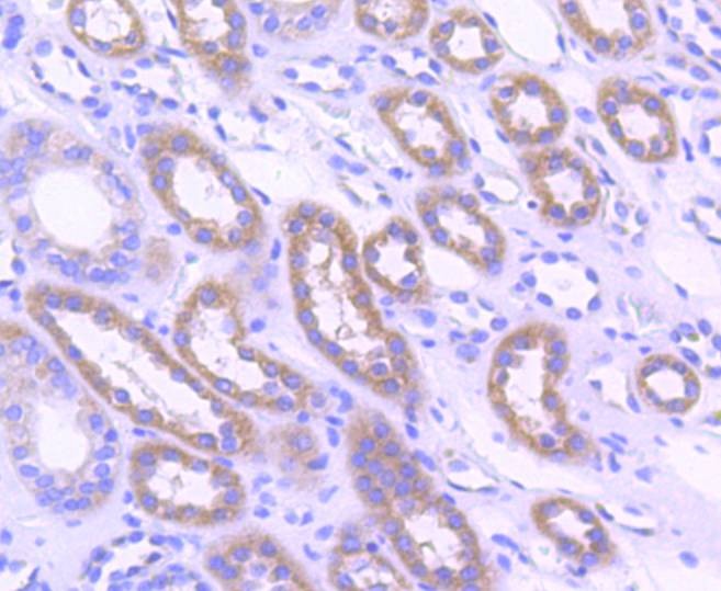 Anti-ACACA Antibody (9D736)