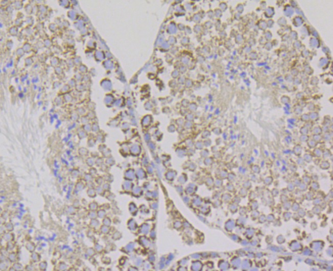 Anti-Aconitase 2 Antibody (9R777)