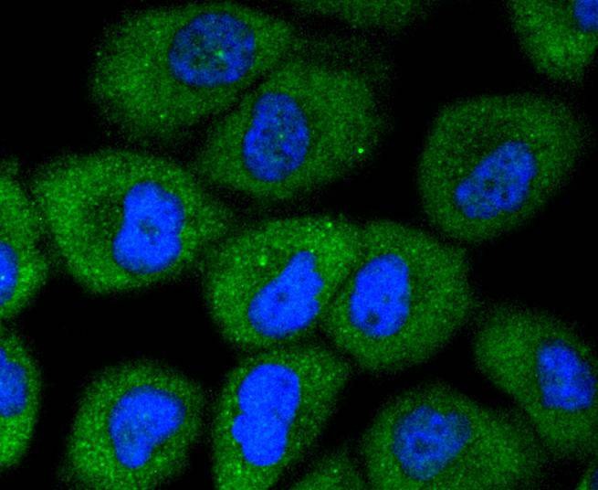 Anti-AKAP14 Antibody (9H736)
