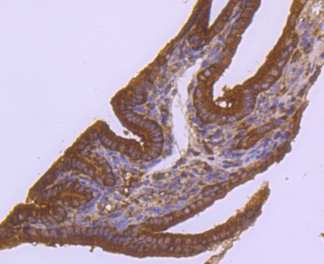 Anti-ABCG2 Antibody (4D379)