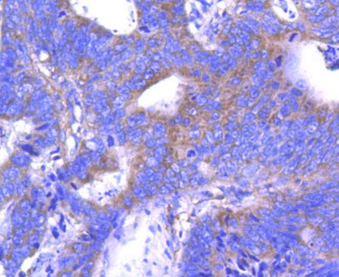 Anti-ABCF1 Antibody (8X278)