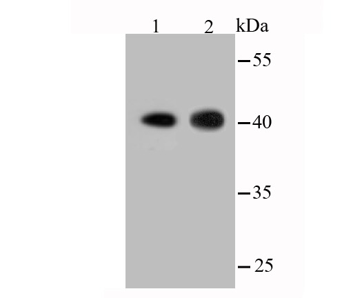 Anti-ACTA1 Antibody (8R189)
