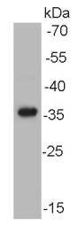 Anti-AKR7A2 Antibody (7I916)
