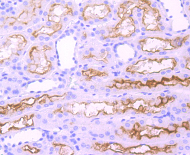 Anti-ACE Antibody (1S991)