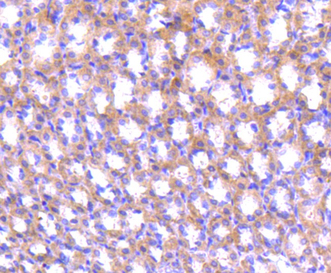 Anti-ABCF1 Antibody (8X278)