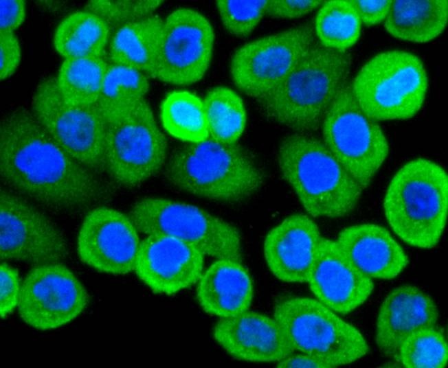 Anti-ACTA1 Antibody (8R189)
