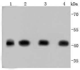 Anti-ACTA1 Antibody (8R189)