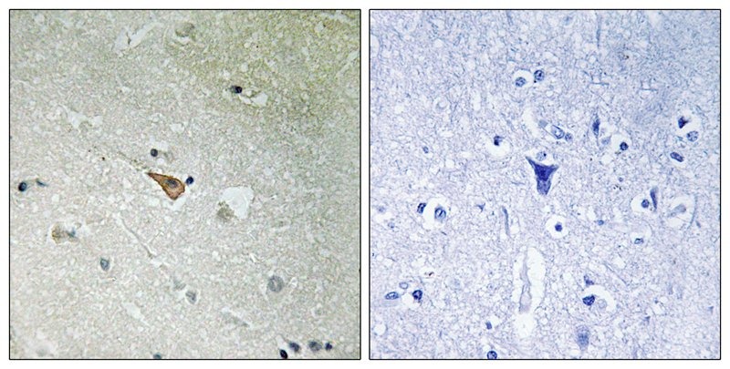 Anti-Phospho-ALK (Tyr1096) Polyclonal Antibody