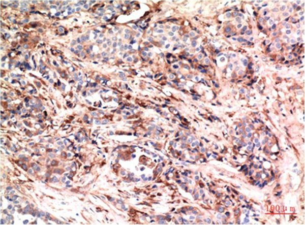 Anti-AKT1 Antibody (9R109)