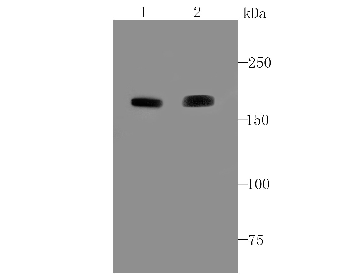 Anti-ACE Antibody (1S991)