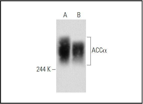Anti-ACACA Antibody (2D514)