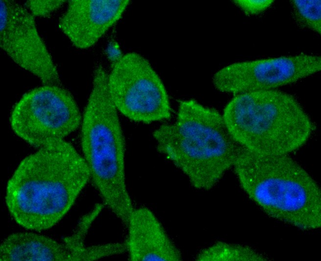 Anti-ABCF1 Antibody (8X278)