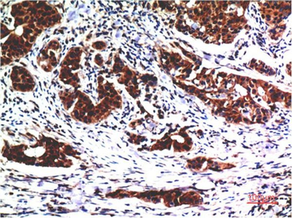 Anti-AKT1 Antibody (7V766)