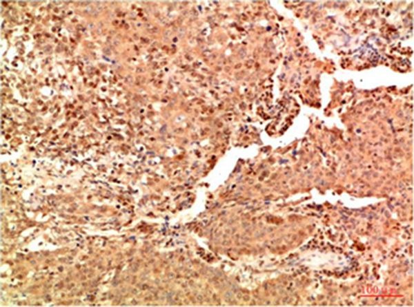Anti-Acetyl-NF-kB p65 (Lys314/315) Antibody (6Z8)