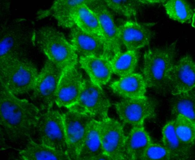 Anti-ACTA1 Antibody (8R189)