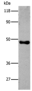 Anti-His Polyclonal Antibody