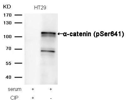 Anti-Phospho-a-catenin (Ser641) Polyclonal Antibody