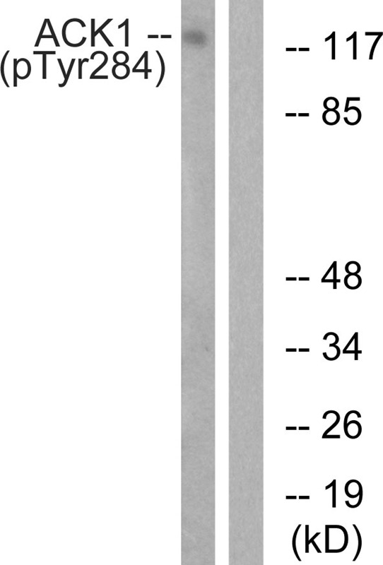 Anti-Phospho-ACK1 (Tyr284) Polyclonal Antibody
