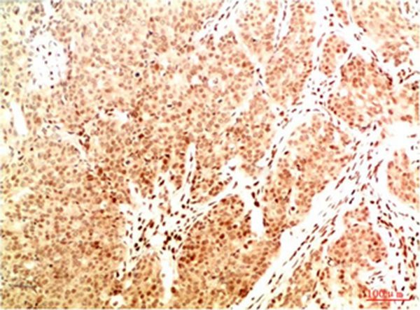 Anti-Acetyl-NF-kB p65 (Lys314/315) Antibody (6Z8)