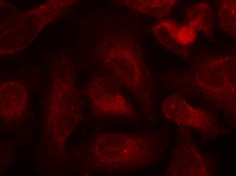 Anti-Phospho-C-ABL1/2 (Tyr393/439) Polyclonal Antibody
