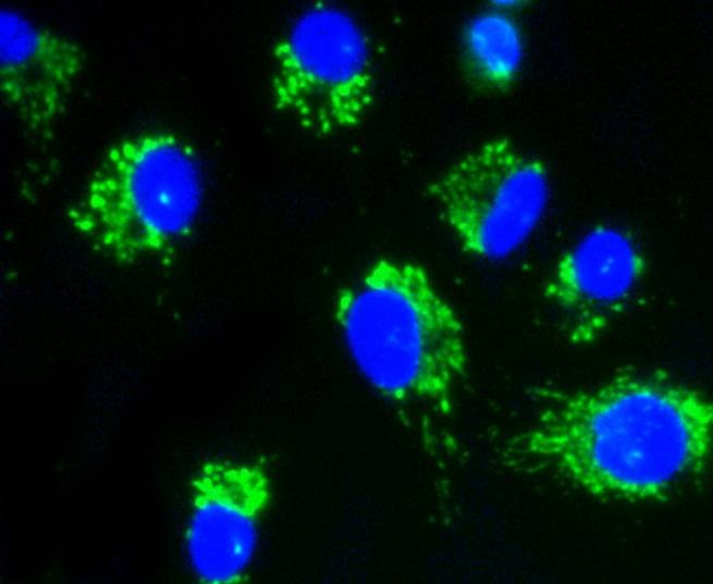 Anti-AKT1/2/3 Antibody (8U152)