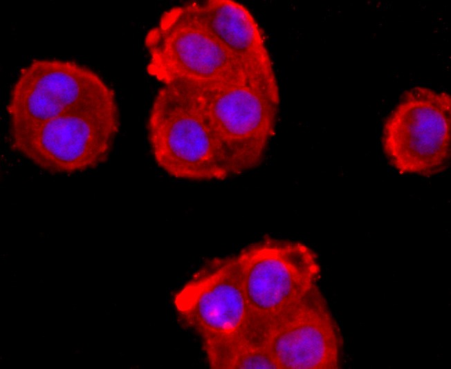 Anti-ADFP Antibody (9D818)