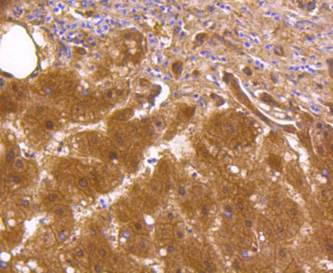 Anti-ALDH1A1 Antibody (5U452)