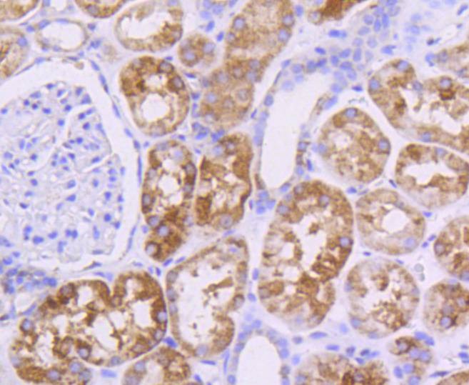 Anti-AKT1/2/3 Antibody (8U152)