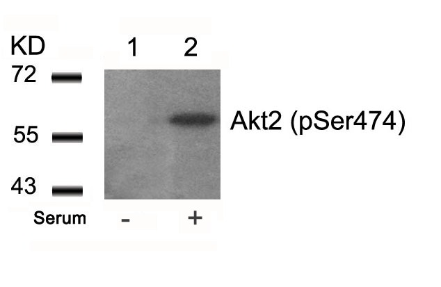 Anti-Phospho-AKT2 (Ser474) Polyclonal Antibody