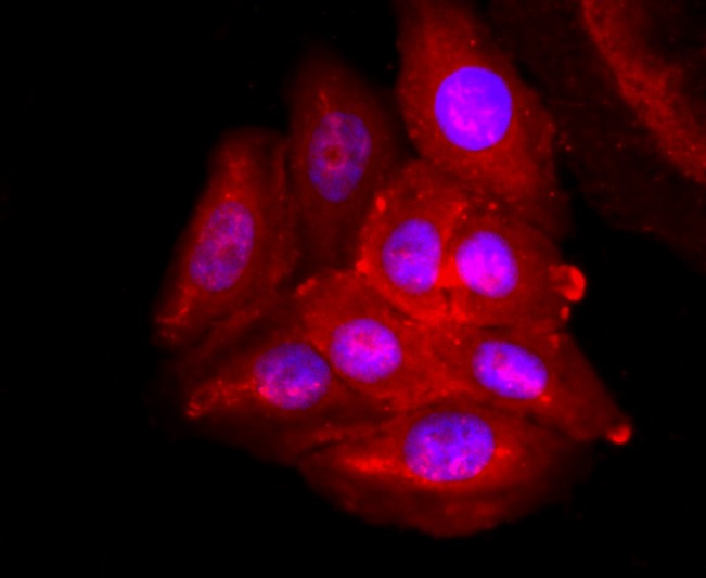 Anti-ADFP Antibody (9D818)