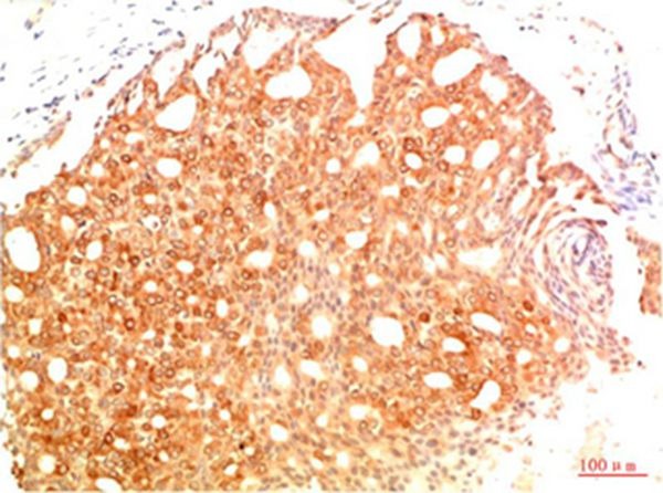 Anti-Acetyl-P53 (Lys382) Antibody (4U766)