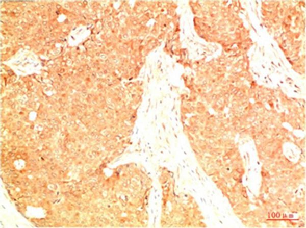 Anti-Acetyl-P53 (Lys382) Antibody (8J875)