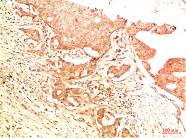 Anti-Acetyl-P53 (Lys382) Antibody (4Z92)