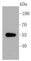 Anti-ALDH1A1 Antibody (5U452)