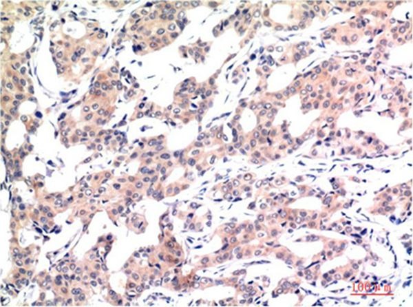 Anti-Acetyl-Histone H3.1 (Lys9) Antibody (5P572)