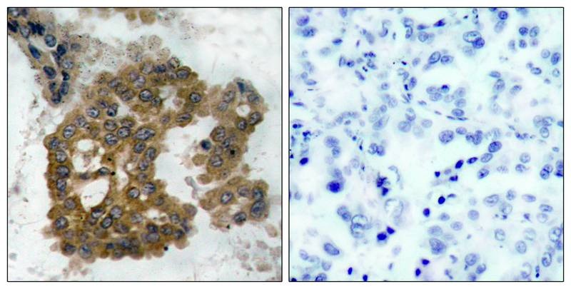 Anti-Phospho-AKT2 (Ser474) Polyclonal Antibody