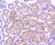 Anti-ADIPOR1 Antibody (2S638)