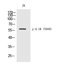 Anti-Phospho-4.1R (Tyr660) Polyclonal Antibody
