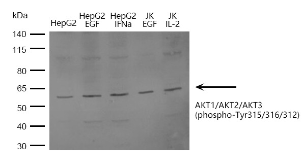 Anti-Phospho-AKT1/2/3 (Tyr315/316/312) Polyclonal Antibody