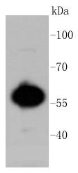 Anti-AKT1/2/3 Antibody (8U152)