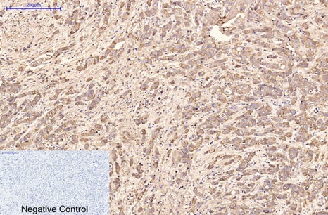 Anti-AFP Antibody (6V105)