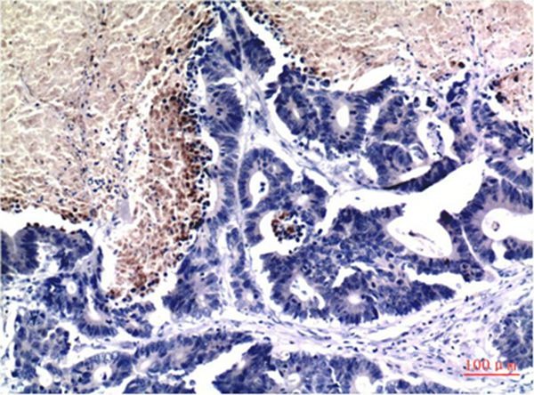 Anti-Acetyl-Histone H3.1 (Lys9) Antibody (5P572)