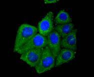 Anti-ADIPOR1 Antibody (2S638)