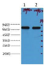 Anti-AFP Antibody (6V105)