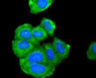 Anti-ADIPOR1 Antibody (2S638)