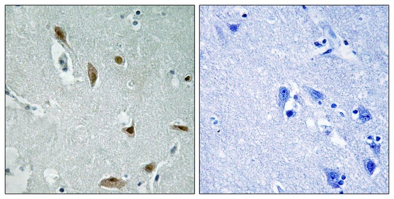 Anti-Phospho-AKT1/3 (Tyr437/434) Polyclonal Antibody