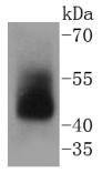 Anti-ADIPOR1 Antibody (2S638)