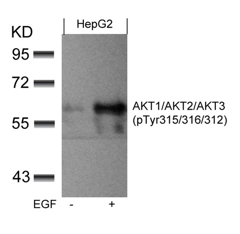 Anti-Phospho-AKT1/2/3 (Tyr315/316/312) Polyclonal Antibody